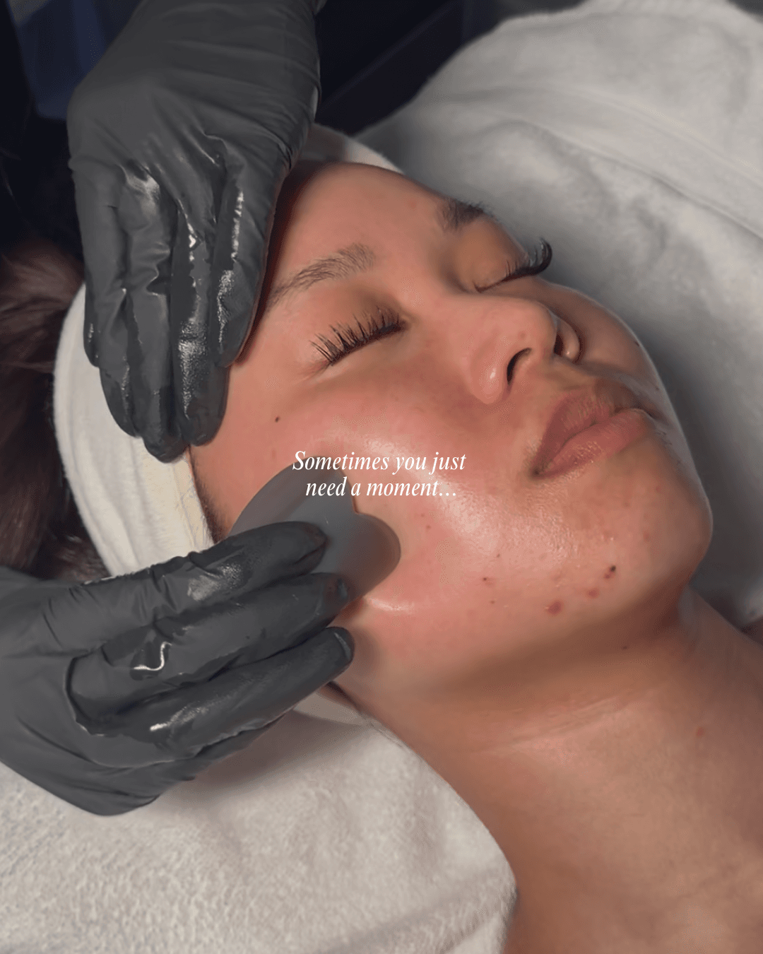 Skin by Vy on Instagram